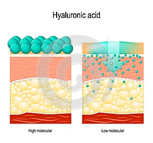 Hyaluronic acid. Hyaluronic acid in skin-care products.