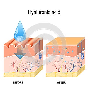 Hyaluronic acid. skin rejuvenation with help of hyaluronic acid photo