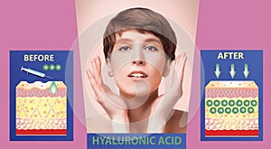 Hyaluronic acid. skin-care products. skin rejuvenation photo