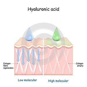 Hyaluronic acid. skin rejuvenation photo