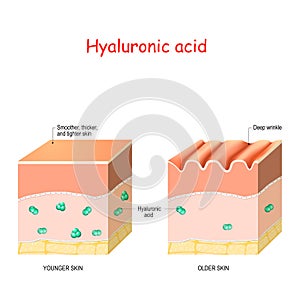 Hyaluronic acid in younger and older skin