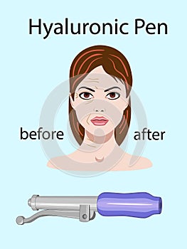 Hyaluronic pens on the light background isolated, vector illustration