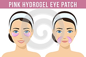 Hydrogel Eye Patches