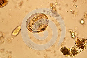 Hymenolepis diminuta