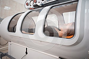 Hyperbaric chamber, treatment and recovery of the body by supplying pure oxygen photo