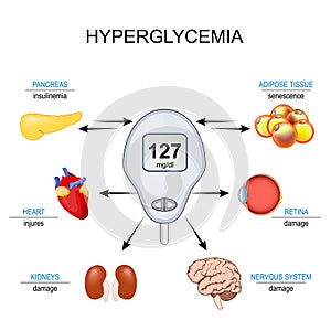 hyperglycemia. Insulin resistance photo