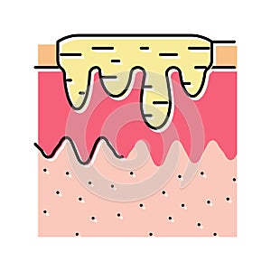 hyperpigmentation acne scar color icon vector illustration photo