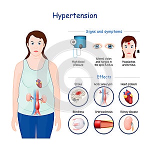 Hypertension. Signs, symptoms, and Effects of High blood pressure