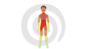 Hyperthermia. Changes in a Body temperature during heat stroke