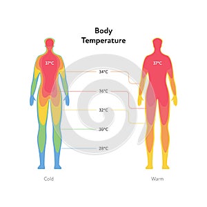 Hyperthermia and hypothermia health care infographic. Vector flat healthcare illustration. Body infrared heat map with celsius