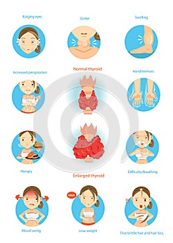 Hyperthyroidism