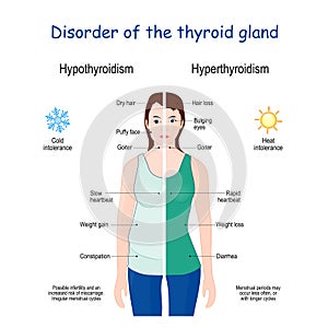 Hyperthyroidism and Hypothyroidism. Female with Signs and symptoms of different thyroid gland diseases photo