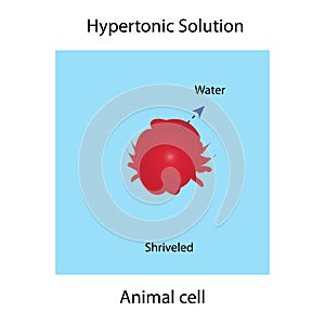 Hypertonic solution