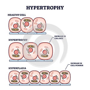 Hypertrophy, hyperplasia or healthy muscular cells comparison outline diagram photo