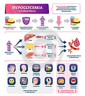 Hypoglycemia vector illustration. Labeled low sugar level medical scheme.