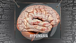 Hypomania in human brain
