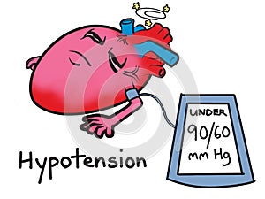 Hypotension Low Blood Pressure Cartoon Illustration photo