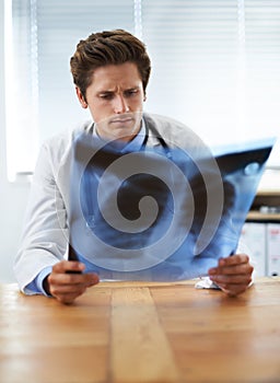 I cant see any problem...a concerned-looking young doctor examining a chest x-ray.