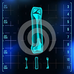 I Letter Vector. Capital Digit. Roentgen X-ray Font Light Sign. Medical Radiology Neon Scan Effect. Alphabet. 3D Blue