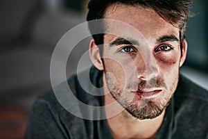 I may be beaten but I wont be broken. Cropped portrait of a beaten and bruised young man looking down.