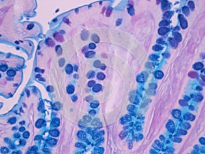 Histology of the Colon photo