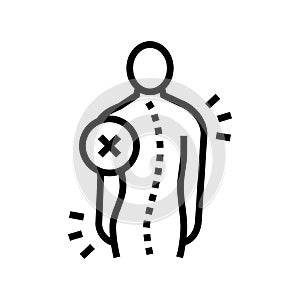 idiopathic scoliosis line icon vector illustration