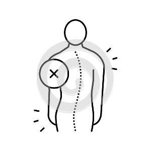 idiopathic scoliosis line icon vector illustration