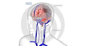 If head trauma occurs, increased stress on the bridging veins can cause them to tear