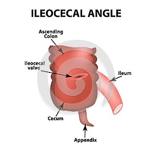 Ileocecal angle. Ileocecal valve. Bauginiev s damper. The ileum, the Cecum, the Apendix. Colon. Infographics. Vector illustration