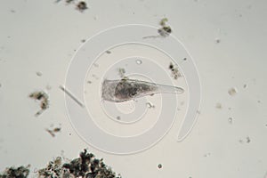 Ð¡iliates infusoria Stentor polymorphic moves by flagella. Protozoa microorganisms