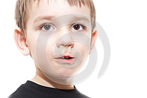 Ill boy with flu and green rhinitis