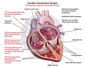 Illustrated Diagram Of Cardiac Conduction System  photo