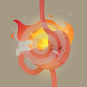 Illustration from acid reflux or heartburn