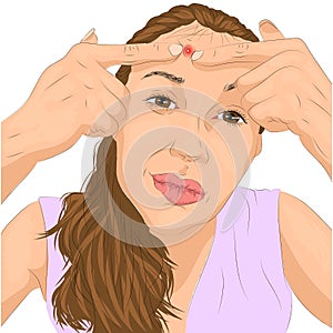 Illustration of acne problem on woman face photo