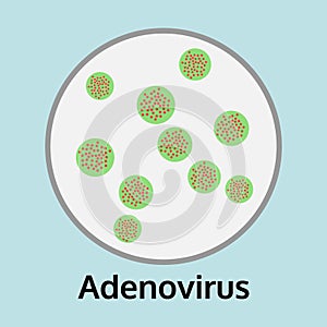 Illustration of Adenovirus disease in the trial tray, medical photo