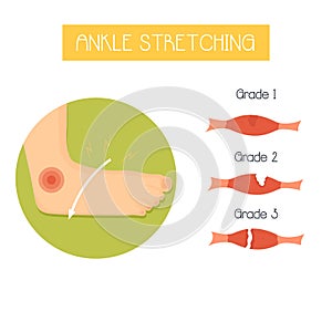 Illustration of ankle stretching and its grades