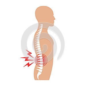 Illustration of back pain. Spine ache.