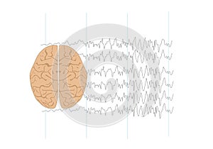 Illustration of brain and abnormal brain waves