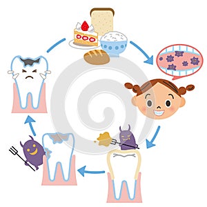 Illustration of the cavity