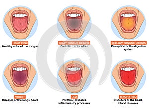 Illustration of diagnosis of different diseases