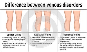Illustration of difference between venous disorders photo