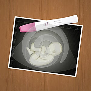 Echography and test pregnancy photo