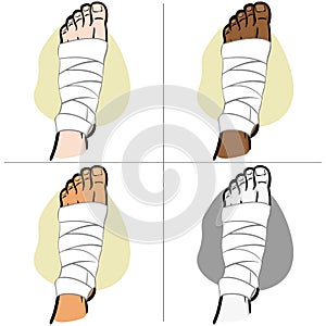 Illustration of firs aid person afro descent, bandaged foot, top view