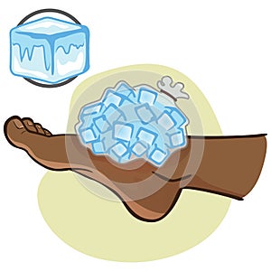 Illustration of first aid person afro descendant, foot with ice bag, side view photo