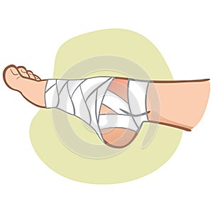 Illustration of first aid person caucasian, bandaged foot, side view