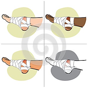 Illustration of first aid person ethnic, bandaged foot, side view