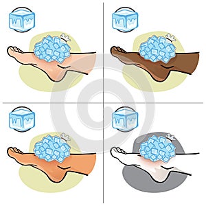 Illustration of first aid person ethnicity, foot with ice bag, side view