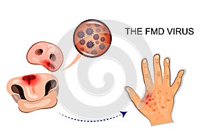 Illustration of the FMD virus and its transmission photo