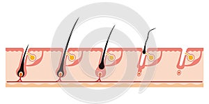 Illustration of a hair cycle