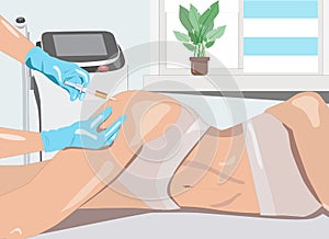 Illustration. Hair removal procedure on a womanâ€™s body.